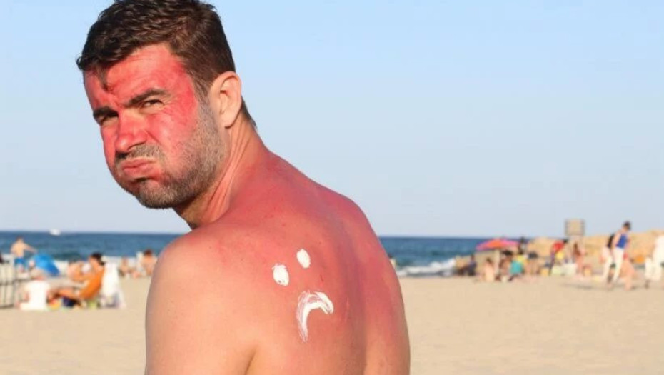 Τελικά ποιες είναι ασφαλέστερες ώρες για ηλιοθεραπεία;