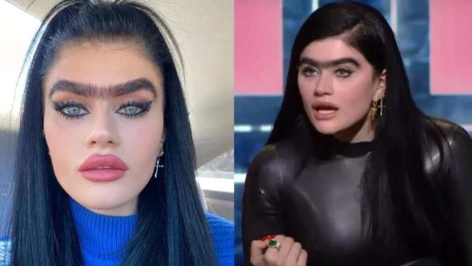 Με άλλα χείλη – μύτη, χωρίς έντονα ζυγωματικά: Διέρρευσε φώτο της Χατζηπαντελή πριν τις πλαστικές