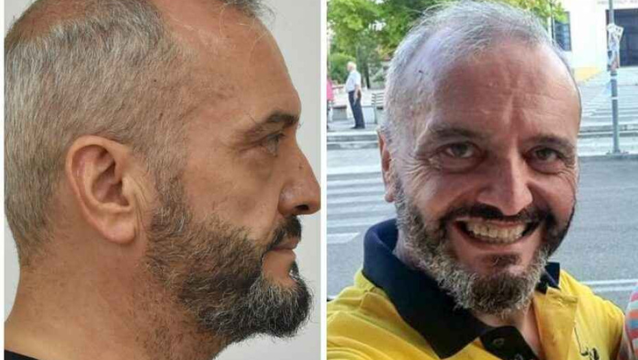 Κολωνός: Ο Ηλίας Μίχος παραδέχεται μόνο την ερωτική σχέση με τη 12χρονη