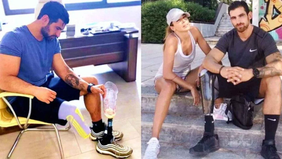 Ετεοκλής Παύλου: «Δεν ντρέπομαι για την αναπηρία μου, η κόρη μου με βοηθάει να βάλω το τεχνητό μέλος μου»