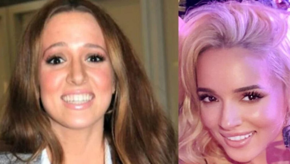 Κατάξανθη, με νέα μύτη και χείλη: Την Καλομοίρα τρόμαξαν να την γνωρίσουν οι θαυμαστές της