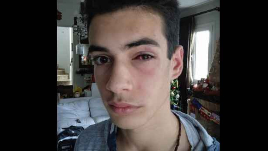 Ξυλοδαρμός 15χρονου στη Χαλκιδική – Η ανάρτηση της μητέρας του