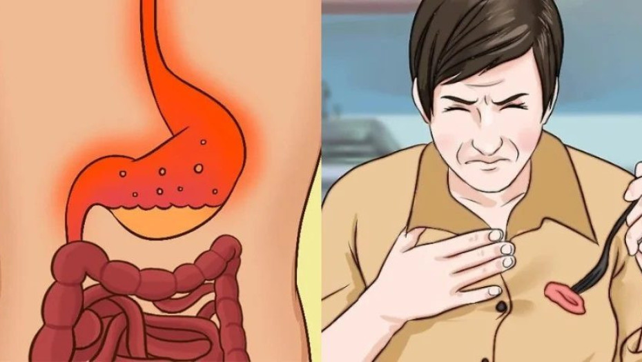 Παλινδρόμηση στομάχου: Γιατί συμβαίνει – Τι να κάνετε – Ποιες τροφές πρέπει να καταναλώνετε