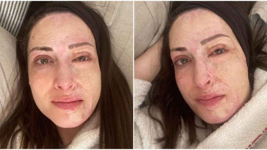 «Ακόμα παλεύω να αποδεχτώ τον νέο μου εαυτό»: Ραγίζει καρδιές η Ιωάννα Παλιοσπύρου χωρίς ίχνος μακιγιάζ