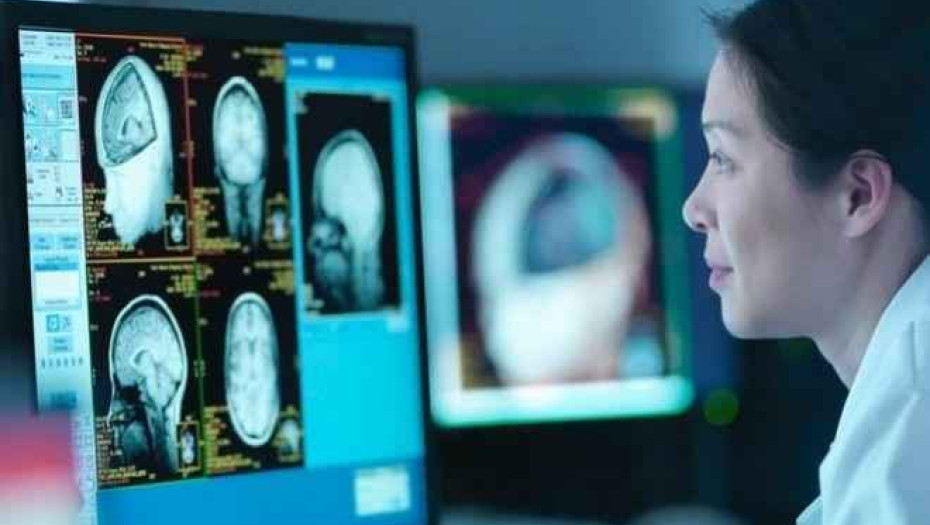 Για πρώτη φορά, επιστήμονες κατέγραψαν τι συμβαίνει στον εγκέφαλο όταν πεθαίνουμε – Τα ευρήματα εντυπωσιάζουν!