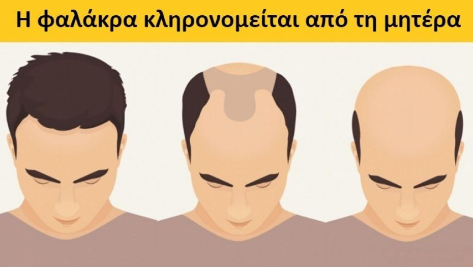 10 προσωπικά χαρακτηριστικά που δεν γνωρίζαμε ότι κληρονομούνται από τους γονείς μας