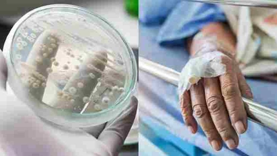 Candida Auris: Τι συμβαίνει με τη διασπορά του μύκητα στα νοσοκομεία – Τι λέει ο Σύψας