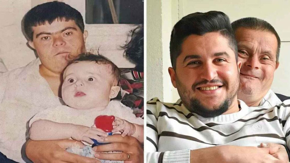 Πατέρας με σύνδρομο Down συστήνει το γιο του που έγινε γιατρός