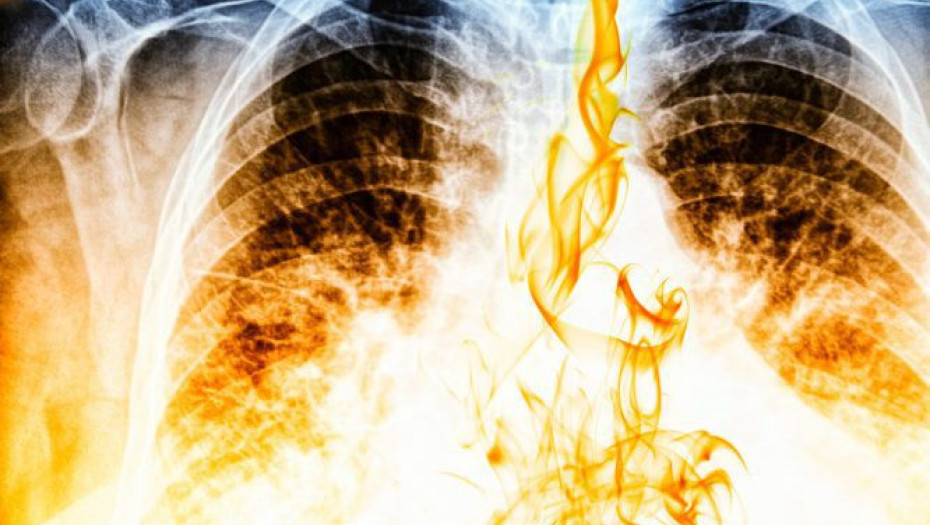 Σε πόσο καιρό θα καθαρίσουν οι πνεύμονες, αν κόψετε σήμερα το κάπνισμα!!!