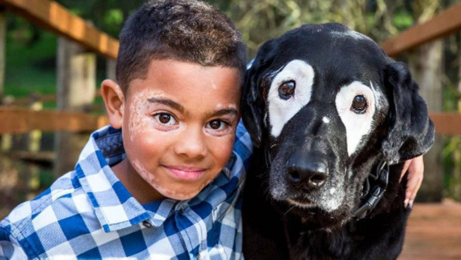 Η ιστορία του αγοριού και του σκύλου που έχουν και οι 2 λεύκη