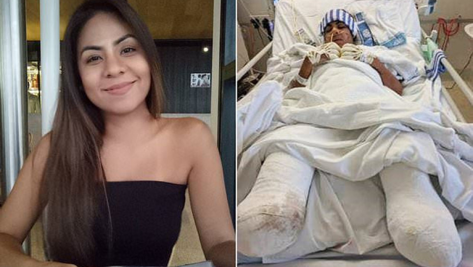 «Όταν Άνοιξα Τα Μάτια Μου, Δεν Είχα Πόδια Και Δάχτυλα Στα Χέρια. Κάτι Τόσο Απλό, Μου Κατέστρεψε Τη Ζωή»