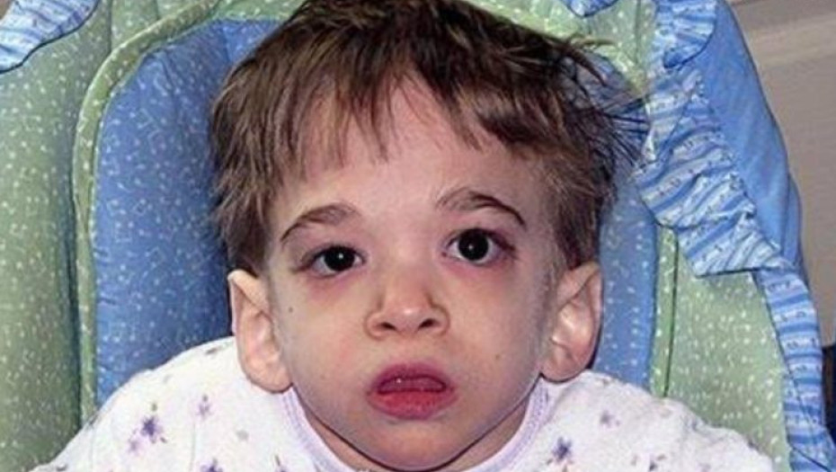 Η Ασθένεια Του Έχει Σοκάρει Τους Γιατρούς Παγκοσμίως. Μόλις Μάθετε ΠΟΣΟ Χρονών Είναι, Θα Σας Πέσει Το Σαγόνι!