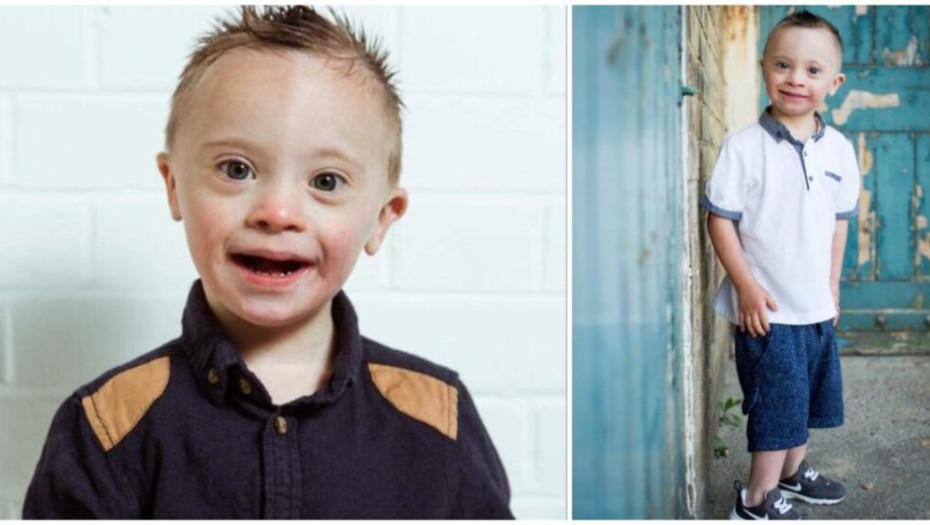 Αγοράκι με Σύνδρομο Down έγινε μοντέλο και κάνει τους πάντες να «λιώνουν» με το χαμόγελό του!