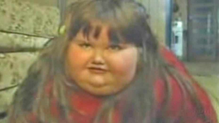 Η μεταμόρφωση της 8χρονης που ζύγιζε 190 κιλά