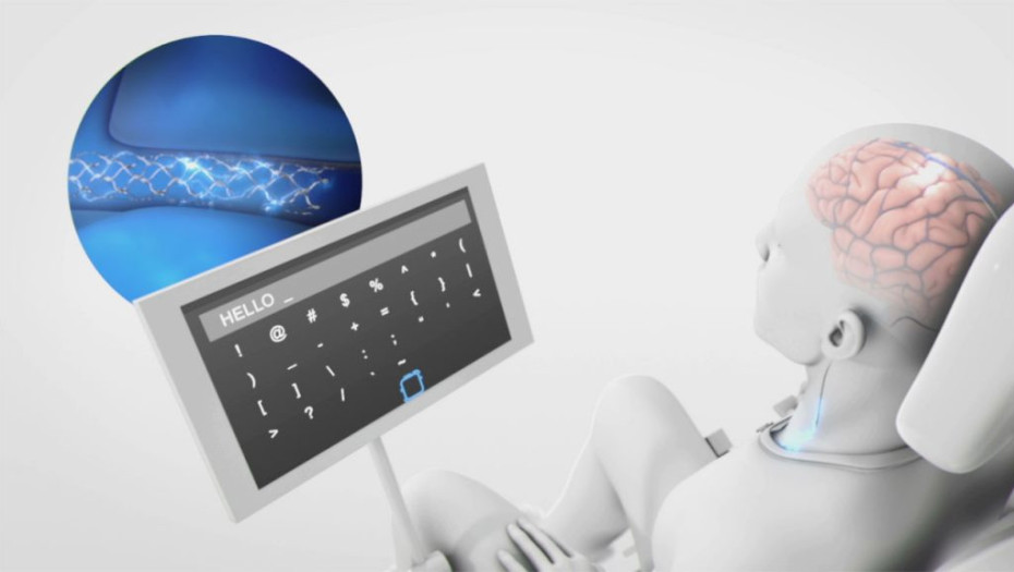 Αυστραλία: Επαναστατική συσκευή θα χαρίσει πίσω την επικοινωνία σε ασθενείς μετά από εγκεφαλικό και ALS!