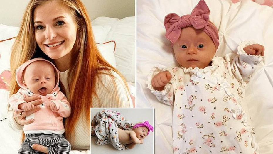 Μητέρα στενοχωρήθηκε όταν έμαθε ότι περιμένει μωρό με σύνδρομο Down αλλά τώρα δε ζει στιγμή χωρίς την κορούλα της