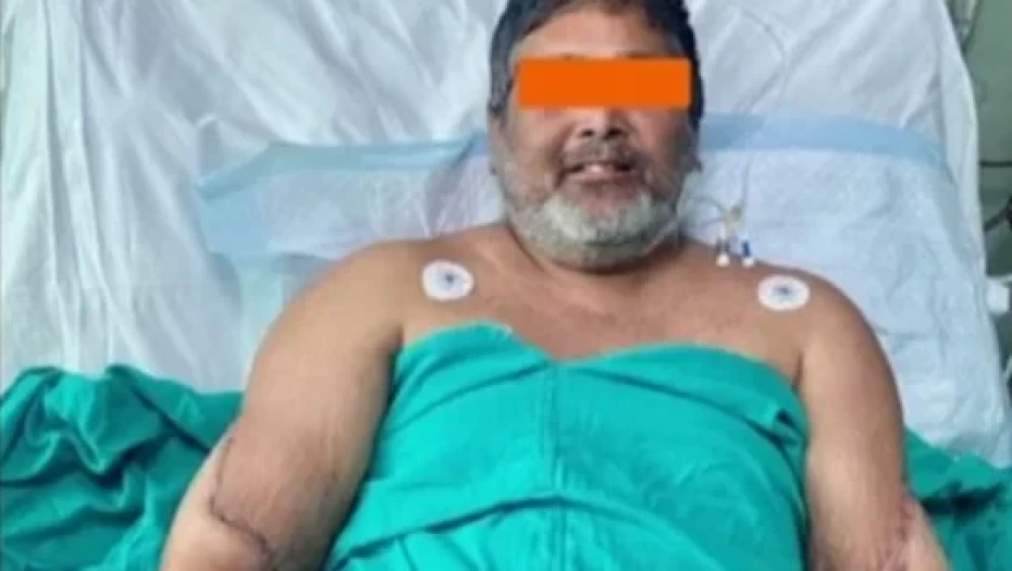 Ινδία: Άνδρας έχει πλέον γυναικεία χέρια ύστερα από σπάνια διπλή μεταμόσχευση