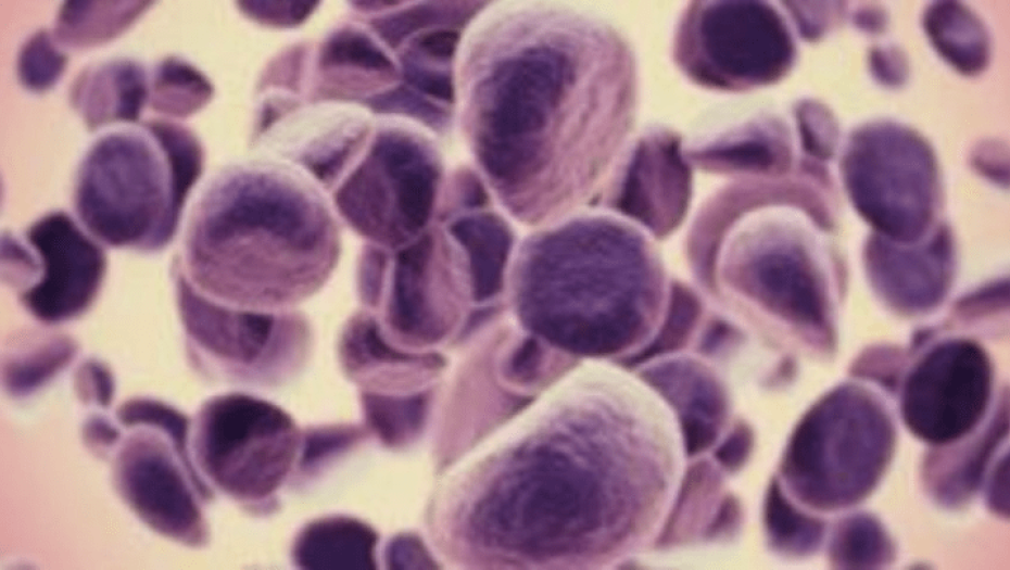 Καινοτόμος μέθοδος για απεικόνιση, διάγνωση και θεραπεία καρκίνου