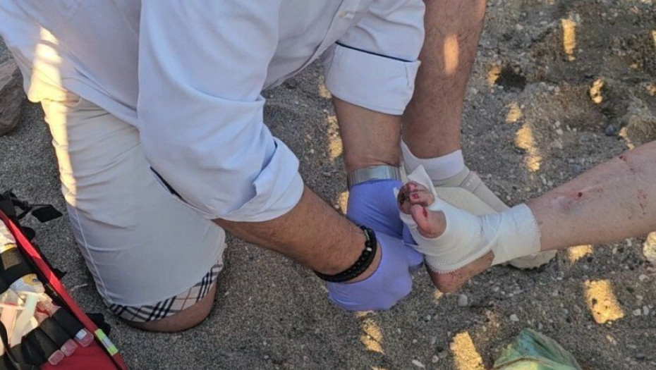 Σοβαρός τραυματισμός γυναίκας από επίθεση θαλάσσιας χελώνας - Δάγκωσε άλλους δύο λουόμενους