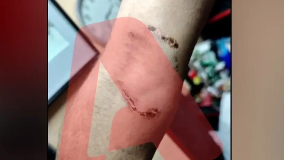 Ομόνοια: Νεαρός έβαλε το πίτμπουλ του να επιτεθεί σε 30χρονο για να τον ληστέψει – «Με έριξε κάτω και το σκυλί με δάγκωνε»