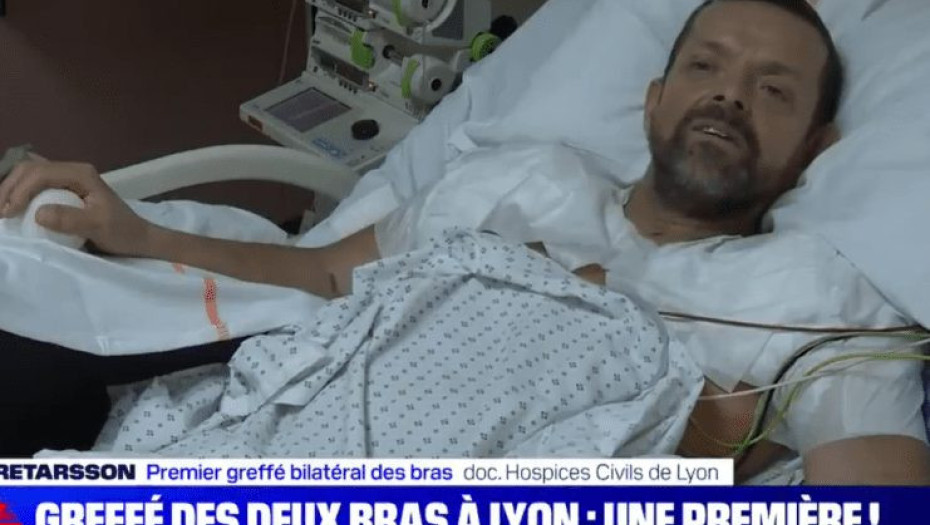 Μεταμόσχευση χεριών από το ύψος του ώμου για πρώτη φορά στα χρονικά! Πρόκειται για ηλεκτρολόγο που είχε χτυπηθεί από 11.000 βολτ και ακρωτηριάστηκε…