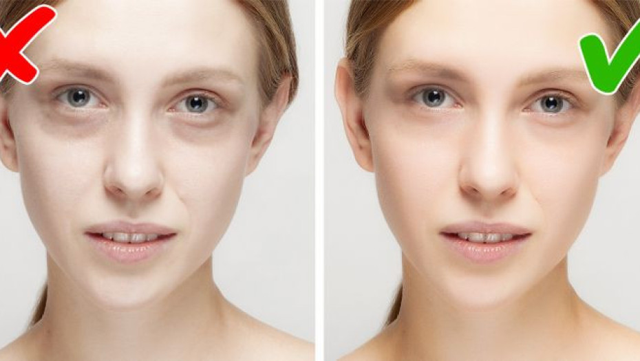 Τα 6 συμπτώματα που φανερώνουν ότι έχετε έλλειψη σιδήρου