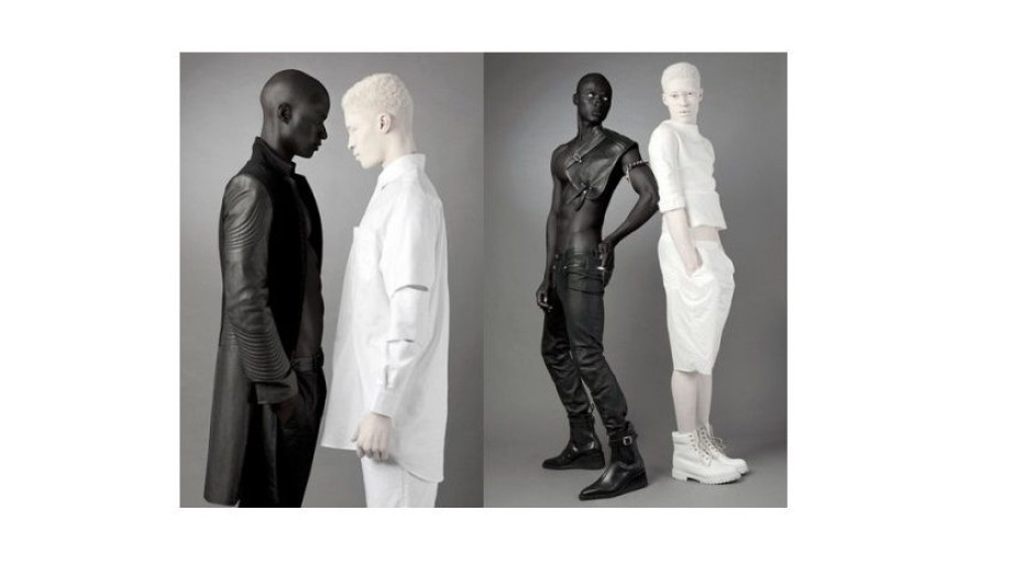 Nέοι με αλμπινισμό που τους κορόιδευαν για την εμφάνισή τους, έγιναν μοντέλα και έσπασαν κάθε στερεότυπο