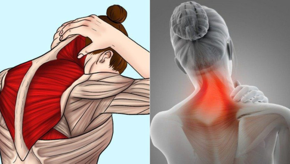 Αυχενικό σύνδρομο: Ποιες οι αίτιες – Ποια τα ανησυχητικά συμπτώματα – Πως να το αντιμετωπίσετε