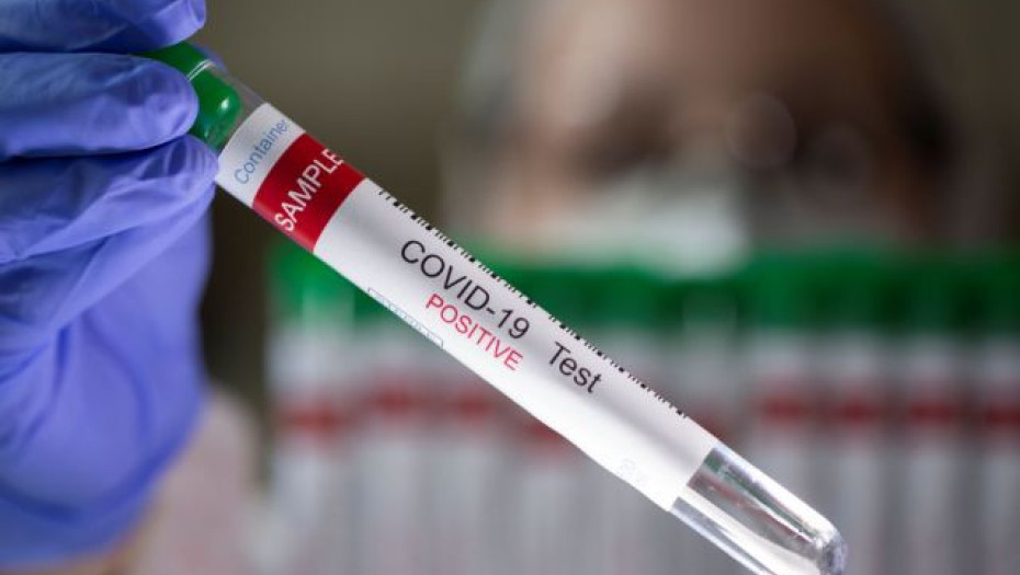 Κορονοϊός: Αυτό είναι το τεστ που θα κάνουμε στο σπίτι