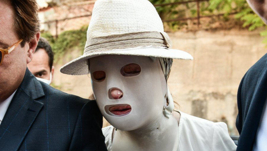 Επίθεση με βιτριόλι: Πόσο μπορεί να μείνει στη φυλακή η δράστις -Το σχόλιο του δικηγόρου της Ιωάννας