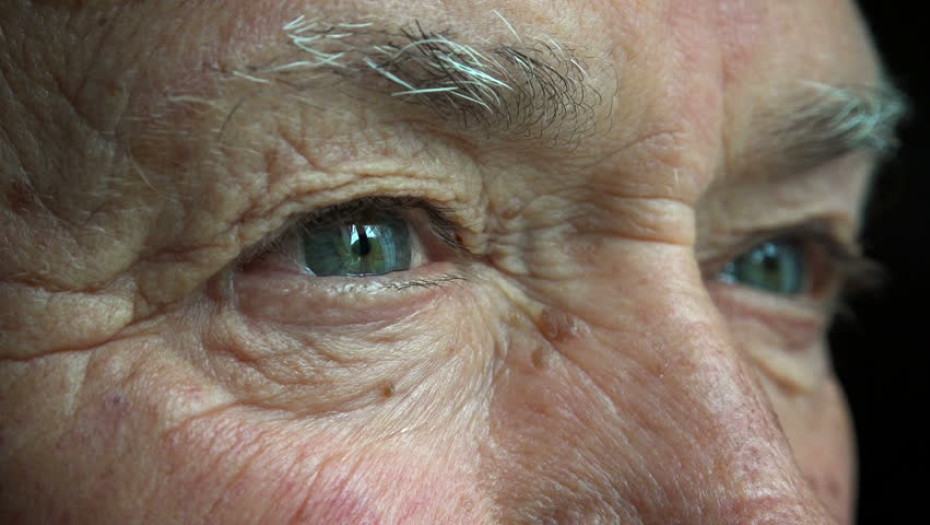 Άνοια – Ποιες παθήσεις του ματιού συνδέονται με την εμφάνισή της