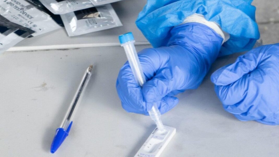 Στο Δήμο Σερρών:  Δωρεάν μαζικά rapid tests από 27 Σεπτεμβρίου έως 1 Οκτωβρίου