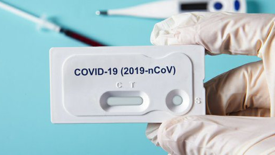 Self test: Tι αλλάζει από σήμερα για τους εργαζόμενους