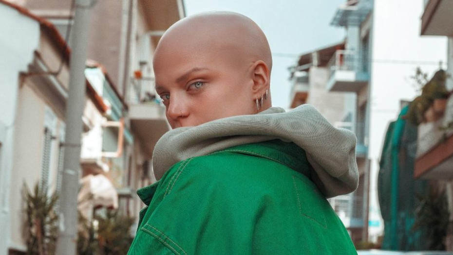 Είμαι η Δωροθέα και έχω αλωπεκία