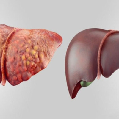 ΚΑΘΑΡΙΣΤΕ ΤΟ ΣΥΚΩΤΙ ΣΑΣ ΜΕ 6 ΦΥΣΙΚΟΥΣ ΚΑΙ ΑΝΩΔΥΝΟΥΣ ΤΡΟΠΟΥΣ-ΣΩΖΕΙ ΖΩΕΣ!