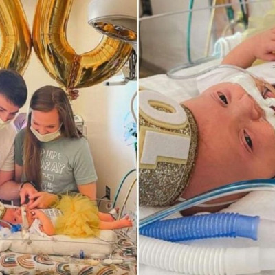 Γονείς γιόρτασαν τις πρώτες 100 μέρες της κόρης τους κάνοντας πάρτι στη… ΜΕΘ νεογνών