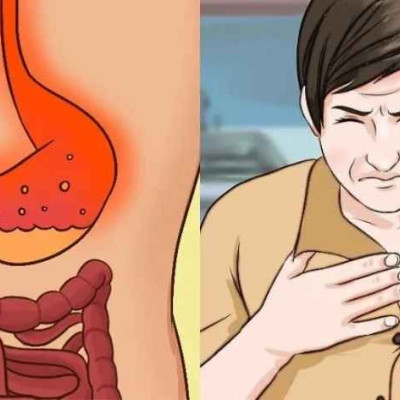 Παλινδρόμηση στομάχου: Γιατί συμβαίνει – Τι να κάνετε – Ποιες τροφές πρέπει να καταναλώνετε