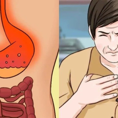 Παλινδρόμηση στομάχου: Γιατί συμβαίνει – Τι να κάνετε – Ποιες τροφές πρέπει να καταναλώνετε