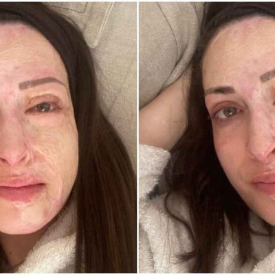 «Ακόμα παλεύω να αποδεχτώ τον νέο μου εαυτό»: Ραγίζει καρδιές η Ιωάννα Παλιοσπύρου χωρίς ίχνος μακιγιάζ