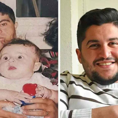 Πατέρας με σύνδρομο Down συστήνει το γιο του που έγινε γιατρός