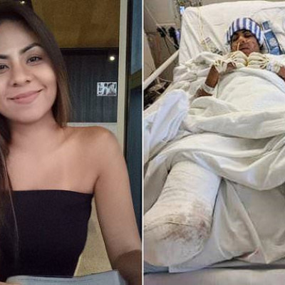 «Όταν Άνοιξα Τα Μάτια Μου, Δεν Είχα Πόδια Και Δάχτυλα Στα Χέρια. Κάτι Τόσο Απλό, Μου Κατέστρεψε Τη Ζωή»