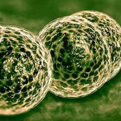 Κρούσμα μηνιγγίτιδας στο ΠΑΓΝΗ: 20χρονος νοσηλεύεται στην παθολογική κλινική