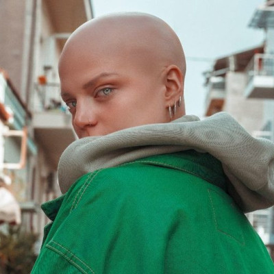 Είμαι η Δωροθέα και έχω αλωπεκία